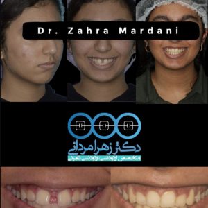دکتر زهرا مردانی متخصص ارتودنسی در بوشهر