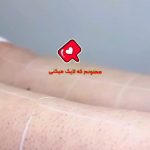 مرکز لیزر رها در ساری