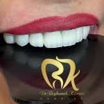 مطب دندانپزشکی ریحانه کریمی در رفسنجان
