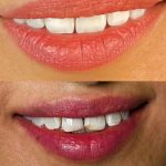 مطب دندانپزشکی ریحانه کریمی در رفسنجان