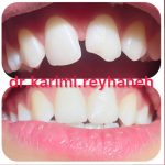 مطب دندانپزشکی ریحانه کریمی در رفسنجان