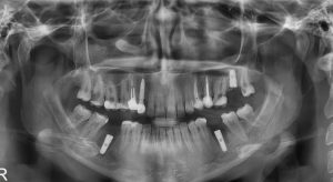 مرکز رادیولوژی تخصصی فک و صورت آراد در تبریز