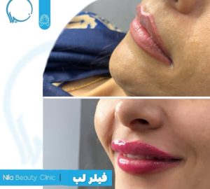 کلینیک زیبایی نیلا در میدان امام بوشهر