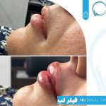 کلینیک زیبایی نیلا در میدان امام بوشهر