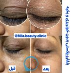 کلینیک زیبایی نیلا در میدان امام بوشهر