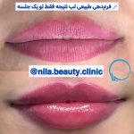 کلینیک زیبایی نیلا در میدان امام بوشهر