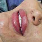 مطب زیبایی بنیتا بیوتی لند در تهران