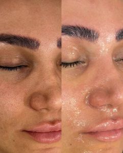 مرکز فشیال پوست سارا در بهبهان