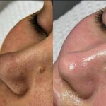 مرکز فشیال پوست سارا در بهبهان