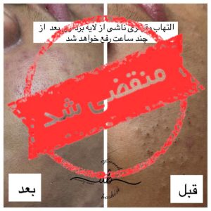 مرکز فشیال پوست افسانه بشیری در فردیس کرج