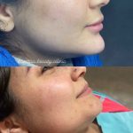 مرکز پوست و لیزر همتا در ساری