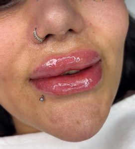 مرکز پوست و لیزر همتا در ساری