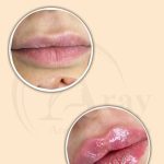 کلینیک زیبایی آرای در میدان هفت حوض تهران