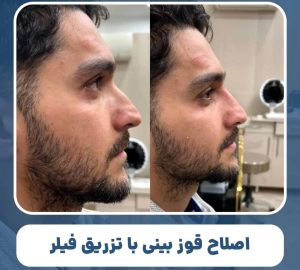 کلینیک زیبایی آرای در میدان هفت حوض تهران 