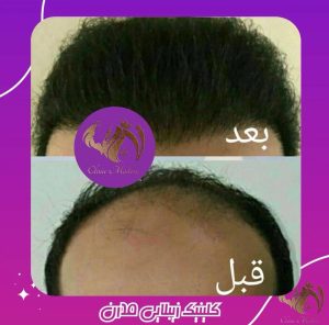 کلینیک زیبایی مدرن در چهارراه خیام قزوین