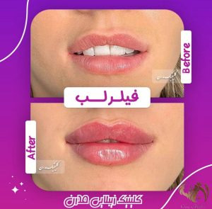 کلینیک زیبایی مدرن در چهارراه خیام قزوین
