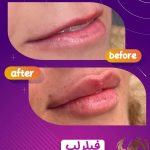 کلینیک زیبایی مدرن در چهارراه خیام قزوین