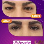 کلینیک زیبایی مدرن در چهارراه خیام قزوین