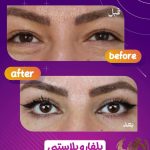 کلینیک زیبایی مدرن در چهارراه خیام قزوین