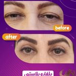 کلینیک زیبایی مدرن در چهارراه خیام قزوین