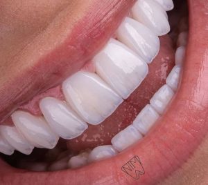 مطب دندانپزشکی دکتر ناطقی راد در شهرک ولیعصر تهران