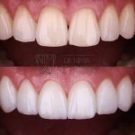 مطب دندانپزشکی دکتر ناطقی راد در شهرک ولیعصر تهران