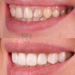 مطب دندانپزشکی دکتر ناطقی راد در شهرک ولیعصر تهران