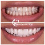 مطب دندانپزشکی دکتر ناطقی راد در شهرک ولیعصر تهران