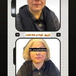 کلینیک پوست و مو یوسف رحیمی در اصفهان