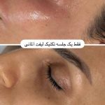 خدمات تخصصی فیشال درمانی مژده احمدزاده در تهران