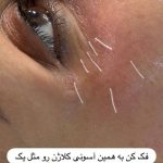 خدمات تخصصی فیشال درمانی مژده احمدزاده در تهران