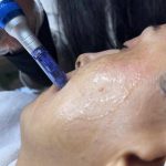 خدمات تخصصی فیشال درمانی مژده احمدزاده در تهران