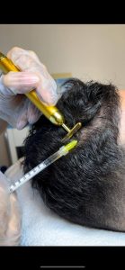 خدمات تخصصی فیشال درمانی مژده احمدزاده در تهران 