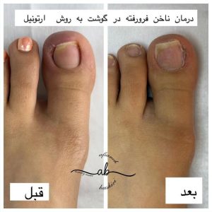 مرکز فشیال پوست افسانه بشیری در فردیس کرج