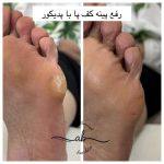 مرکز فشیال پوست افسانه بشیری در فردیس کرج