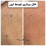 مرکز فشیال پوست افسانه بشیری در فردیس کرج