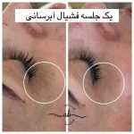 مرکز فشیال پوست افسانه بشیری در فردیس کرج