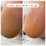 مرکز فشیال پوست افسانه بشیری در فردیس کرج