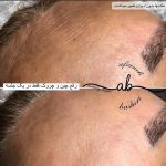 مرکز فشیال پوست افسانه بشیری در فردیس کرج