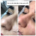 مرکز فشیال پوست افسانه بشیری در فردیس کرج