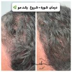 مرکز فشیال پوست افسانه بشیری در فردیس کرج