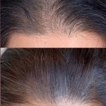 کلینیک زیبایی لاندا در پونک تهران