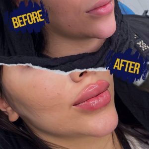 کلینیک زیبایی لاندا در پونک تهران