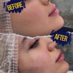 کلینیک زیبایی لاندا در پونک تهران