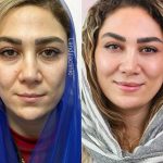 کلینیک زیبایی لاندا در پونک تهران