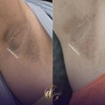 کلینیک زیبایی لاندا در پونک تهران