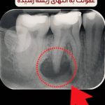 مطب دندانپزشکی دکتر نبوی در آزادی تهران