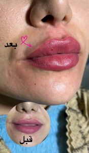 مرکز زیبایی دکتر حسین رحمانی در زنجان