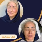 مرکز زیبایی دکتر حسین رحمانی در زنجان