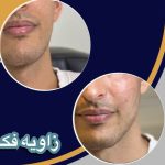 مرکز زیبایی دکتر حسین رحمانی در زنجان